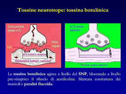 Spasticità post-ictale ridotta dalla tossina botulinica anche tramite una riorganizzazione corticale [FISIOTERAPIA E RIABILITAZIONE]