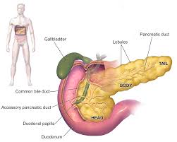 Diabete guarisce con un grammo di grasso in meno nel pancreas
