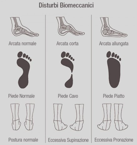 Scarpe da ginnastica: la flessibilità deforma l’arco plantare