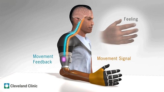 Un sistema di robot permette alle protesi di “sentire” il movimento